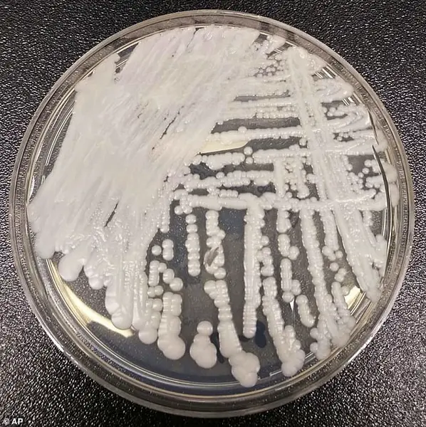 Deadly, Treatment-Resistant Fungus Spreading Rapidly in U.S. Hospitals Raises Alarms Among Health Officials
