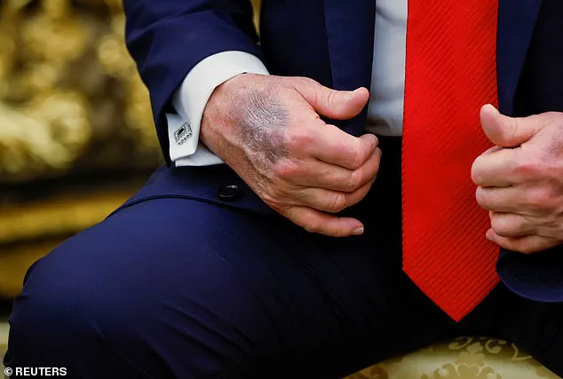 Trump's Defiance of Medical Advice on Aspirin Dosage Raises Expert Concerns