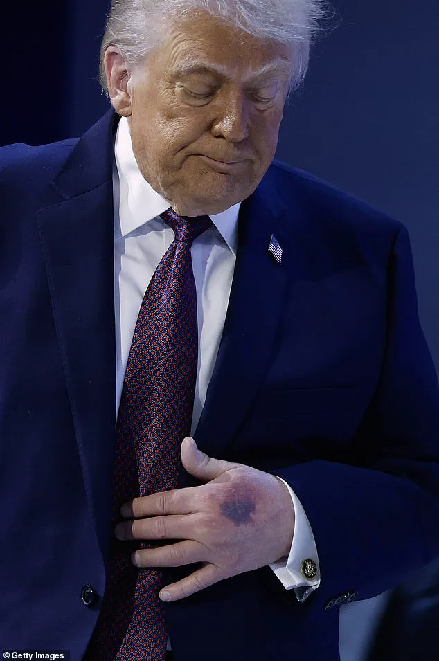 Urgent: Trump Dismisses Alzheimer's Concerns, Struggles to Recall Name in New York Magazine Interview