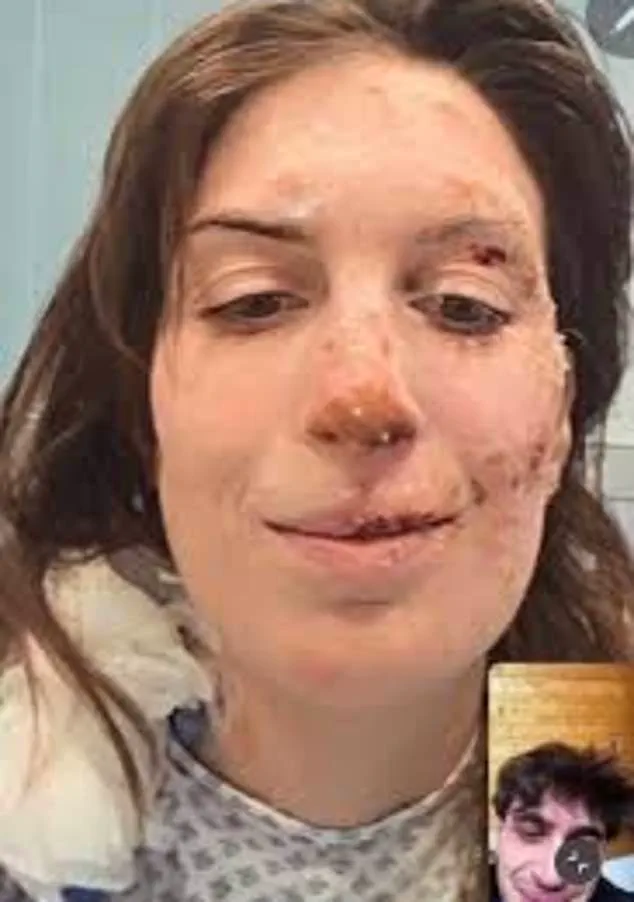 Eleonora Palmieri's Duality: Physical Recovery and the Soul's Lingering Scars After the Le Constellation Inferno