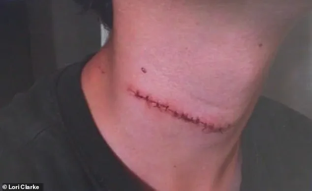 Carefree Family Getaway Turns Tragic as Teen Suffers Neck Slash at Daytona Beach