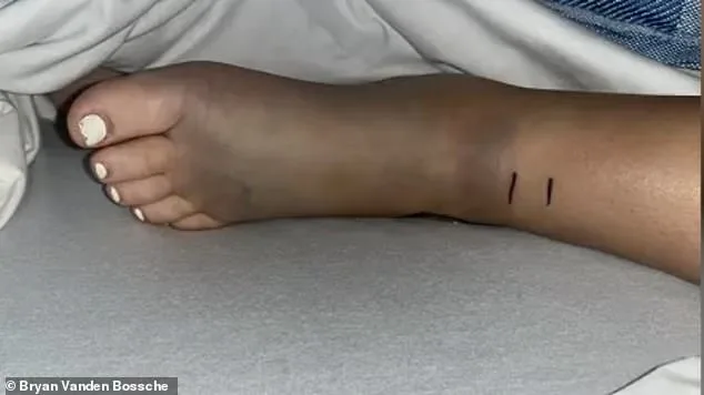 14-Year-Old Girl Survives Near-Fatal Rattlesnake Bite During Bike Ride in California